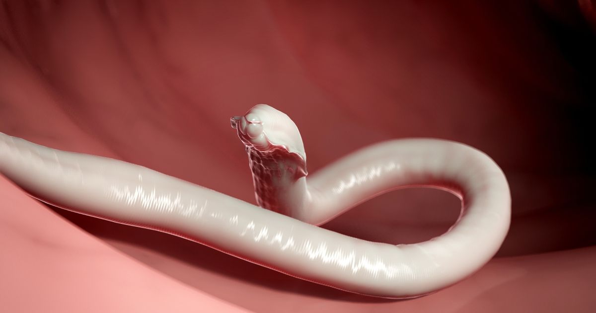 Live wriggling worm pulled from patient’s brain as neurosurgeon ‘feels sick’