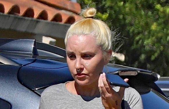 Amanda Bynes appears to be getting heart-shaped face tattoo removed
