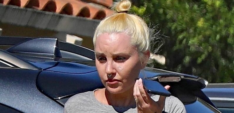 Amanda Bynes appears to be getting heart-shaped face tattoo removed