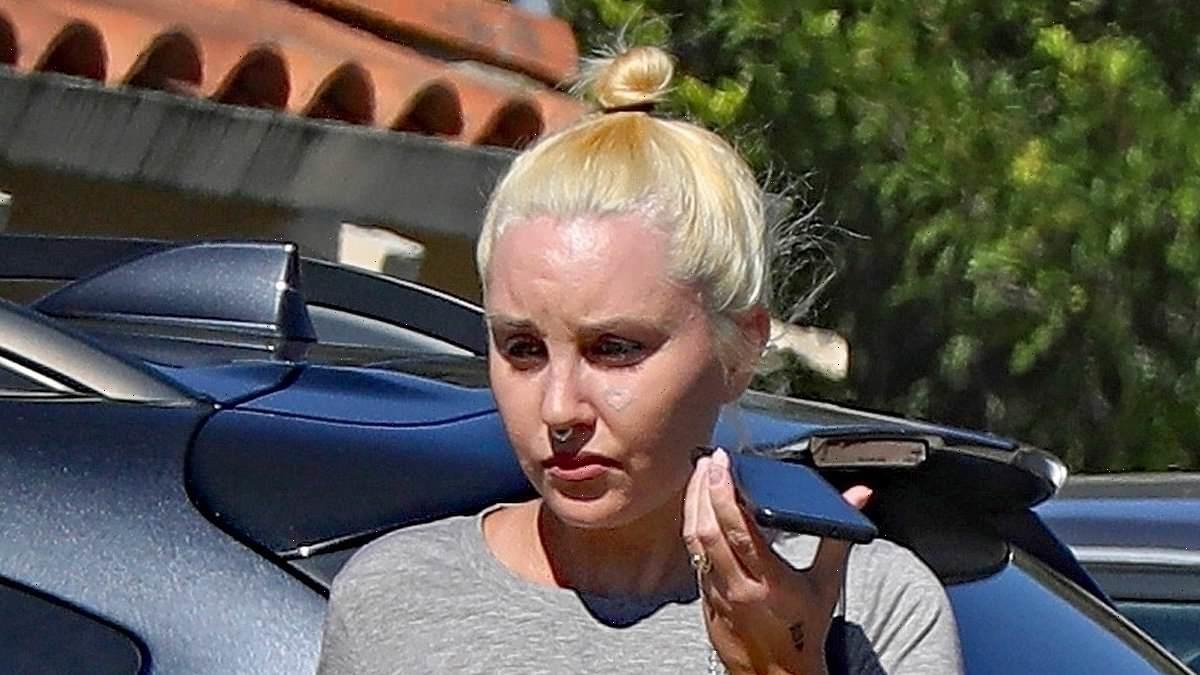 Amanda Bynes appears to be getting heart-shaped face tattoo removed
