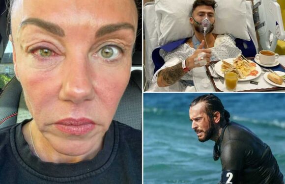 Celebrity SAS’s most horrific injuries from Pete Wicks being knocked out cold to Michelle Heaton’s ‘swamp eye’ | The Sun