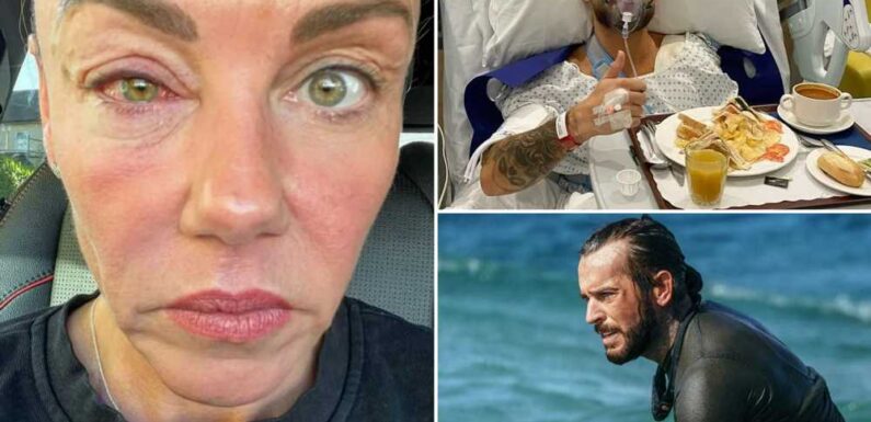 Celebrity SAS’s most horrific injuries from Pete Wicks being knocked out cold to Michelle Heaton’s ‘swamp eye’ | The Sun