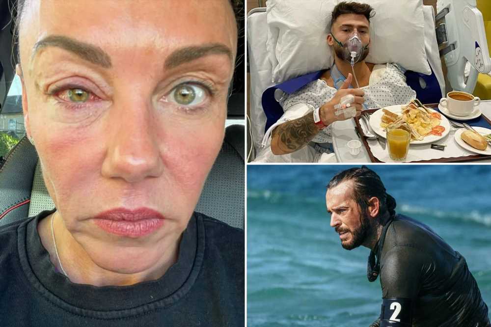 Celebrity SAS’s most horrific injuries from Pete Wicks being knocked out cold to Michelle Heaton’s ‘swamp eye’ | The Sun