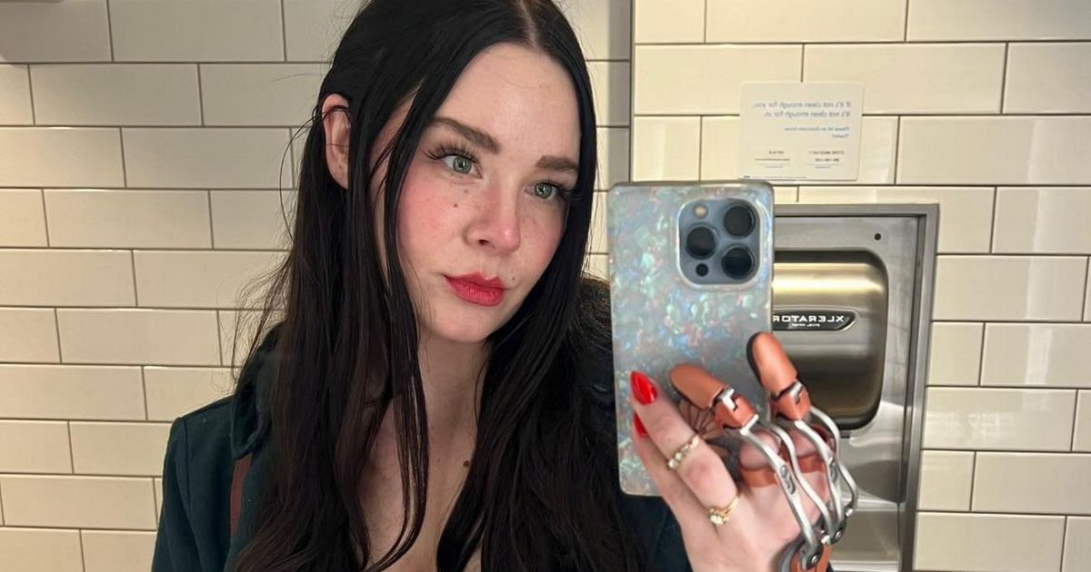 ‘I lost my fingers in freak accident – now I’m being harassed by fetishists’