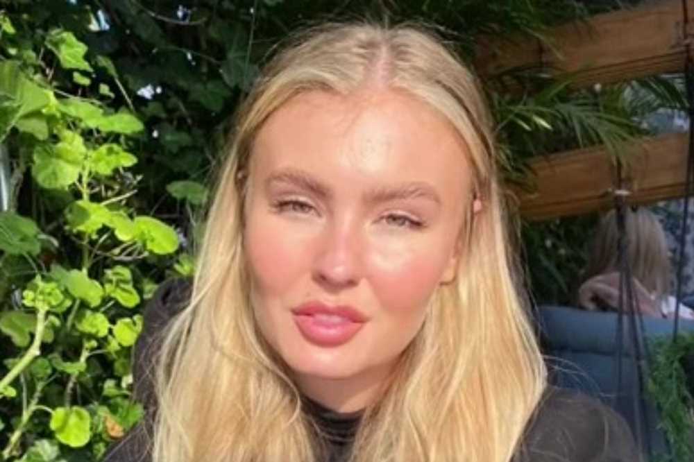 I used to love bushy brows & filler but then I had it removed – and now everyone calls me 'uniquely beautiful' | The Sun
