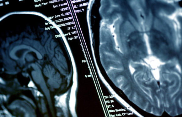 Non-medical staff operating on brains, spines after ‘learning on the job’