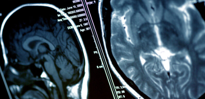 Non-medical staff operating on brains, spines after ‘learning on the job’