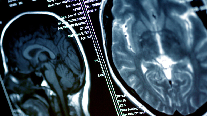 Non-medical staff operating on brains, spines after ‘learning on the job’