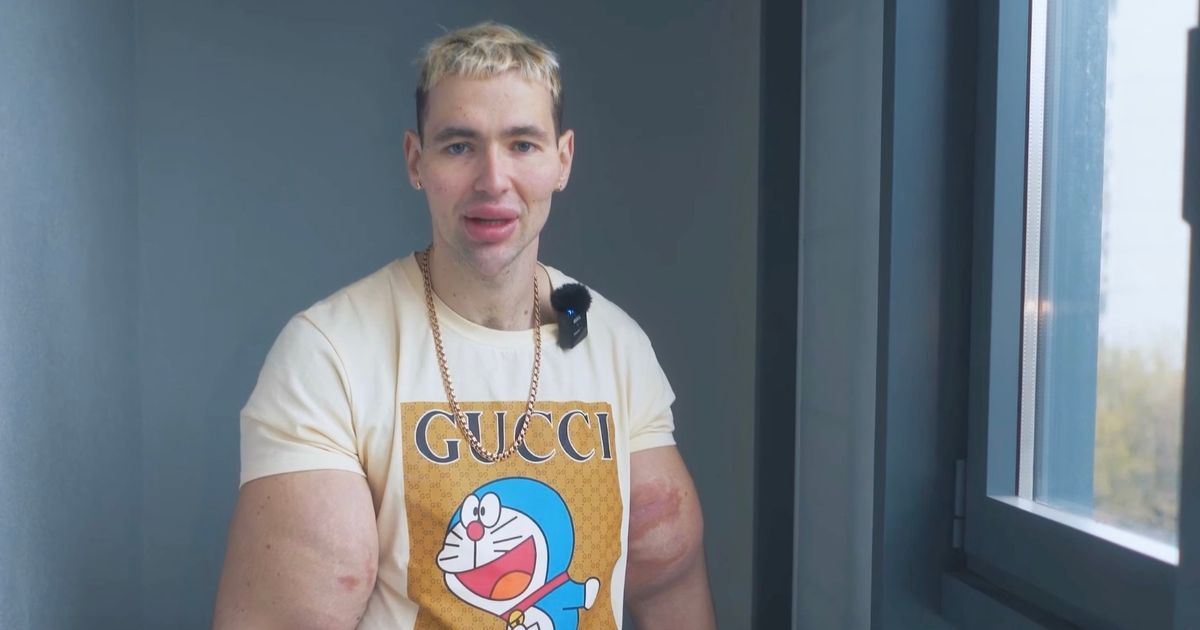 Russian ‘Popeye’ opens up home with dirty bog and razor to shave before sex