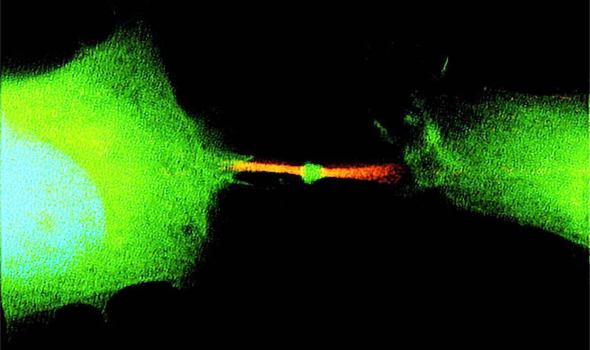 ‘Trash can of the cell’ responsible for spreading cancer, new study warns