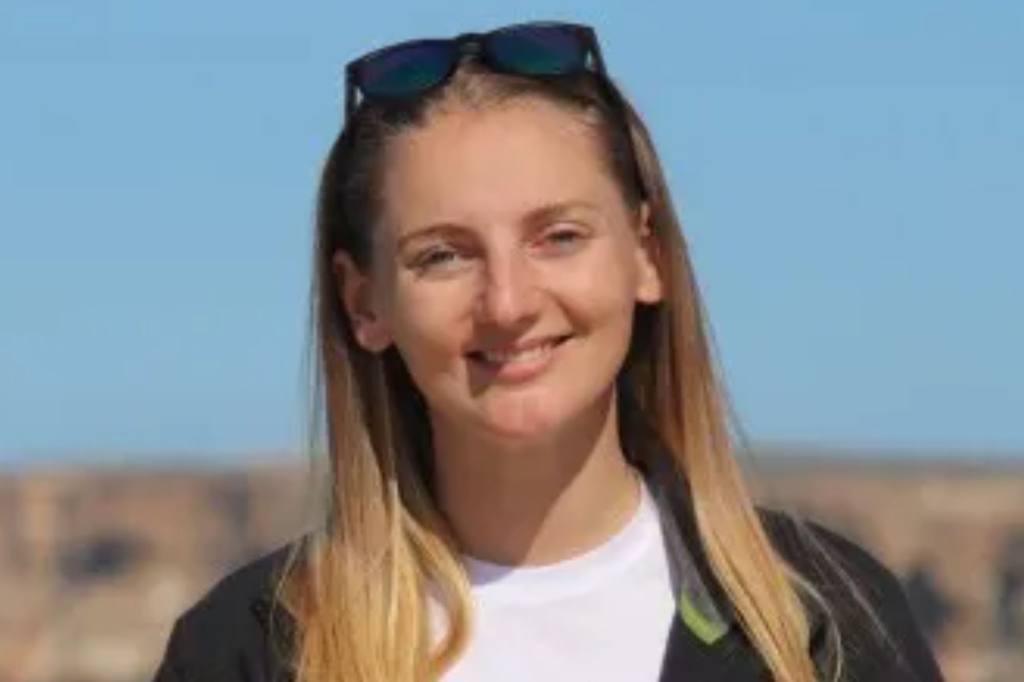 Diver bitten on head by great white shark has TEETH removed from her skull after suffering horror facial injuries | The Sun