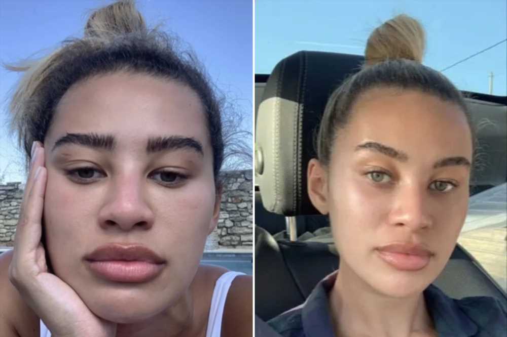 SAS Who Dares Wins star Montana Brown praised by fans as she shows off ‘real face’ after getting filler dissolved | The Sun