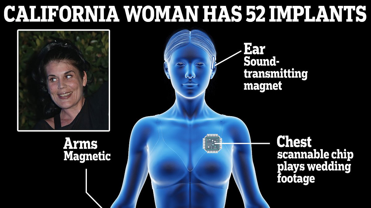 The world's ultimate cyborg! California woman has 52 implants