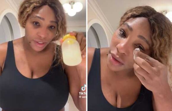 Serena Williams Puts Her Own Breast Milk On Sunburns! WHAT?!