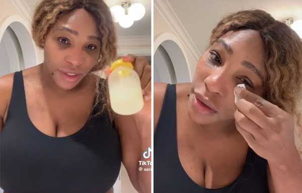 Serena Williams Puts Her Own Breast Milk On Sunburns! WHAT?!